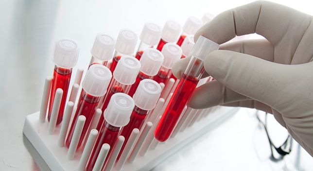 Crean prueba de sangre que detecta el cáncer