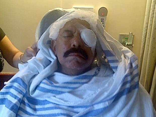 Oscar D’León perdió la visión del ojo izquierdo, se recupera en casa