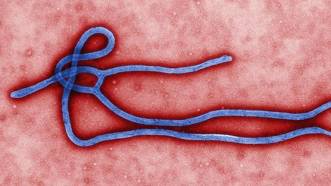 MinSalud descarta ébola en Colombia, ante supuestos casos