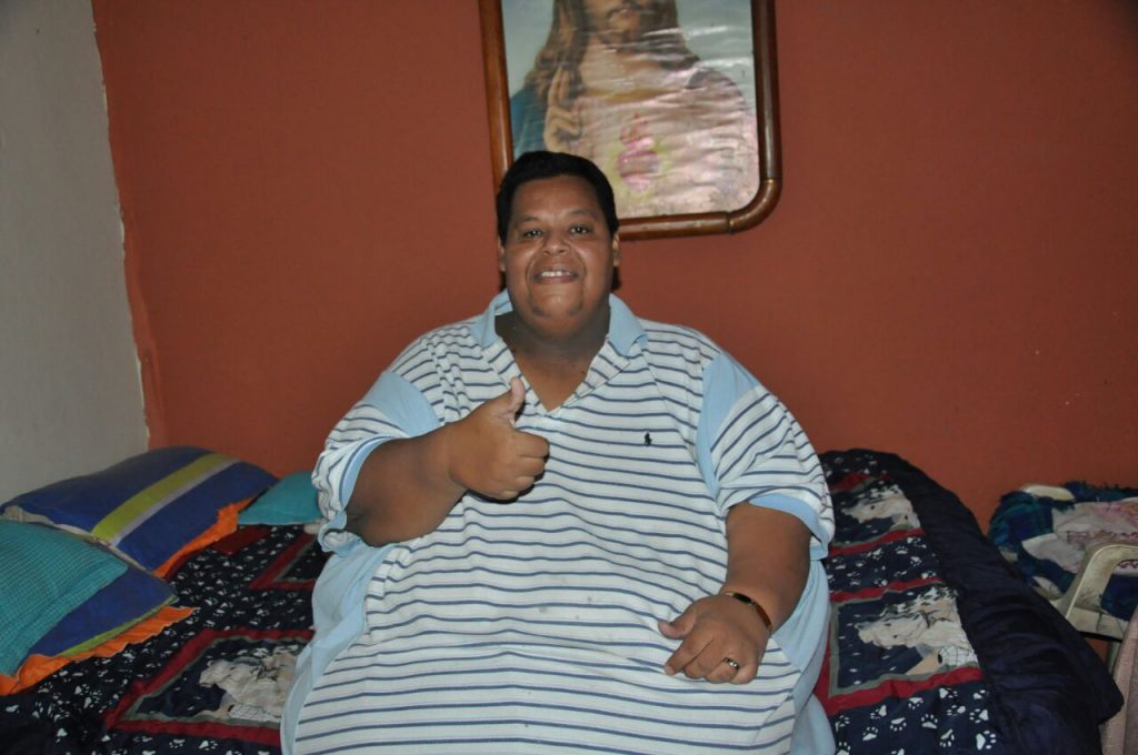 El hombre más obeso de Colombia será operado en Cali