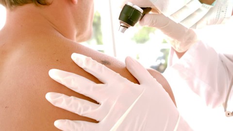 UCEVA llevará a cabo día de atención gratuita para prevenir cáncer de piel