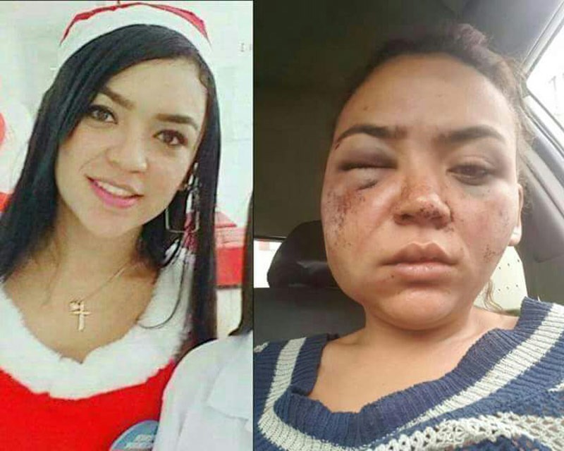 Mujer vallecaucana denuncia fuerte golpiza de su novio en Quito, Ecuador
