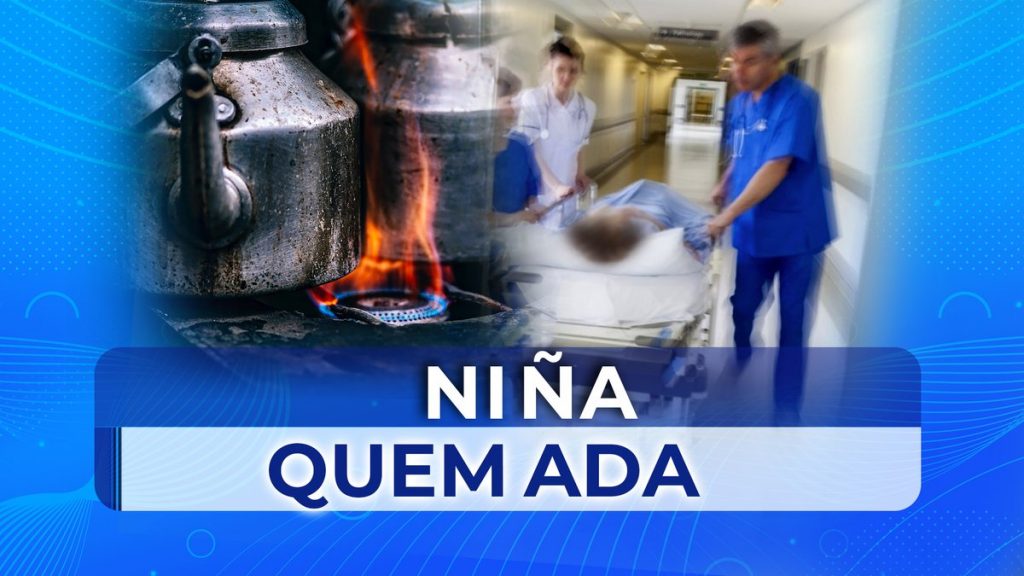 Menor de 2 años habría sido quemada por un líquido hirviendo por su madre en Pradera
