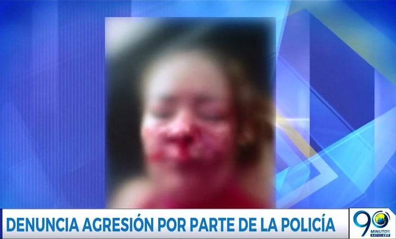 Mujer en Cali asegura que un policía la golpeó brutalmente con una patada en su rostro
