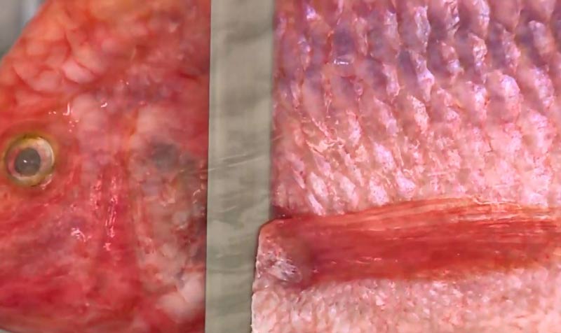 En Cali se realizó la primera construcción de vagina con piel de tilapia