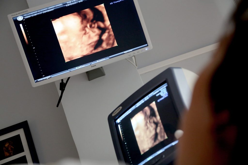Joven que abortó en su séptimo mes de gestación, ya había hablado de problemas psicológicos