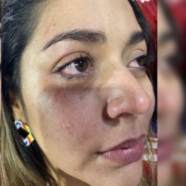 Mujer dice que fue agredida por hinchas del América Pascual Guerrero