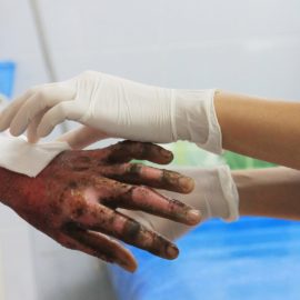 "Hay personas con quemaduras extensas": reporte de heridos en cárcel de Tuluá