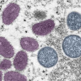 OMS registró 1.000 casos de viruela del mono y advirtió sobre su riesgo