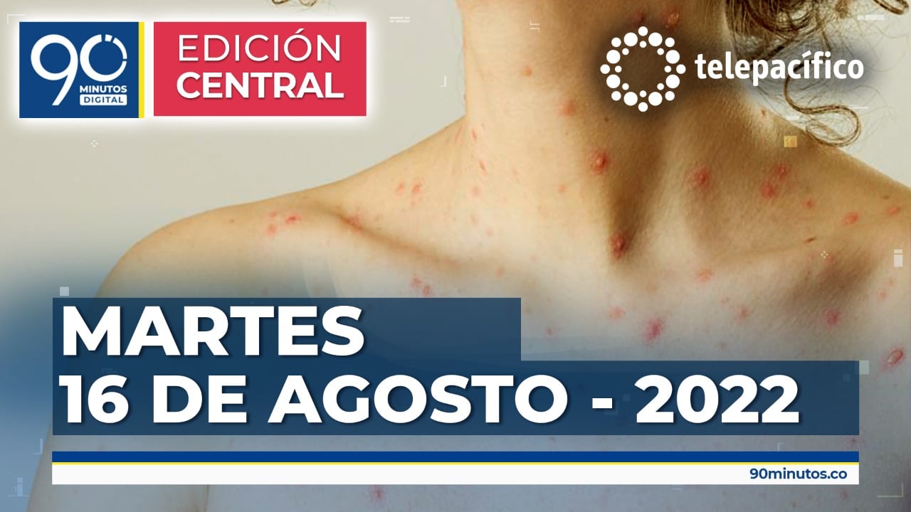 Emisión de miércoles 17 de agosto de 2022