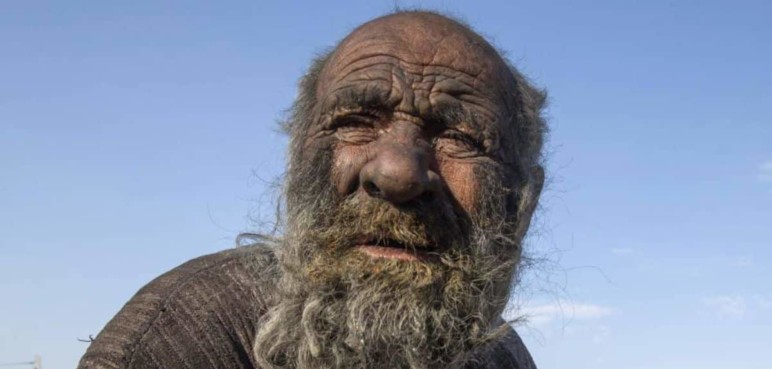 Falleció el hombre catalogado como el más sucio del mundo a sus 94 años