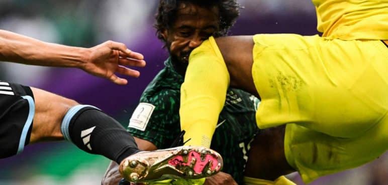 Impactante: Así se rompió la mandíbula el jugador de Arabia Saudita en el Mundial
