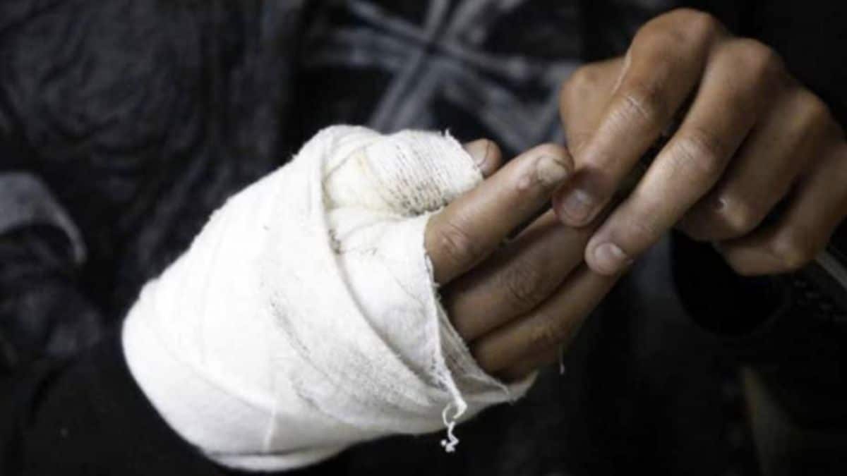 Suben a cuatro los lesionados por pólvora en el Valle del Cauca