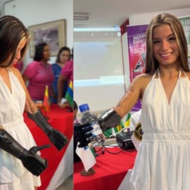 Karol Bastidas, ejemplo e inspiración: la deportista ya tiene sus prótesis robóticas