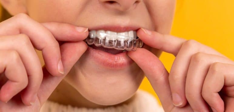 Bienestar y dientes brillantes: Con estos tips podrá tener una buena salud dental