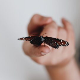 Conociendo sobre la 'piel de mariposa': Una particular enfermedad que aún no tiene cura