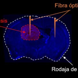 Avance científico permite detectar metástasis y lesiones en el cerebro, ¿de qué se trata?