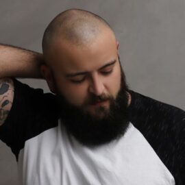 ¿Existe un tratamiento efectivo para la alopecia? Experta responde