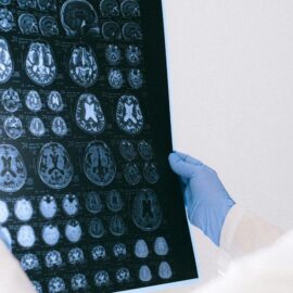 Conocido actor de la serie Grey's Anatomy fue diagnosticado con extraña enfermedad