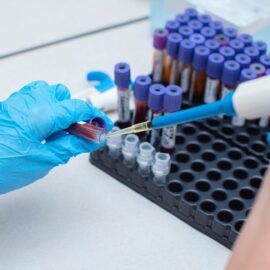 Alerta por VIH en Colombia: Casos aumentan y expertos llaman a la prevención