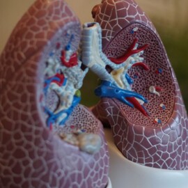 ¿Qué es la hipertensión pulmonar? enfermedad que puede llegar a ser mortal