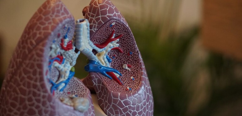 ¿Qué es la hipertensión pulmonar? enfermedad que puede llegar a ser mortal