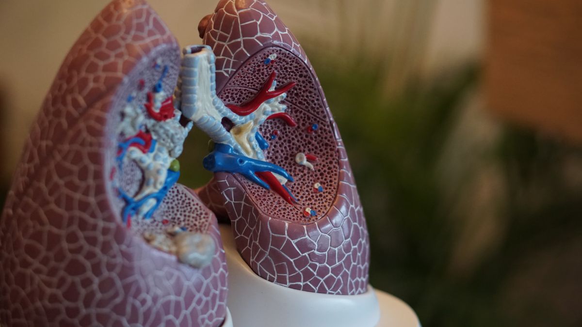Cáncer de Ovario: estas son las señales de alerta, según experta