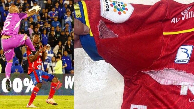 ¡Polémica! Cuestionan decisión arbitral ante dolorosa lesión de jugador del Pasto