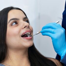 ¿Cada cuánto ir al odontólogo? La clave para prevenir caries y mantener una sonrisa sana