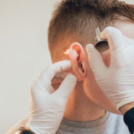 Este programa apoya a niños con microtia en Cali; una enfermedad que afecta el oído