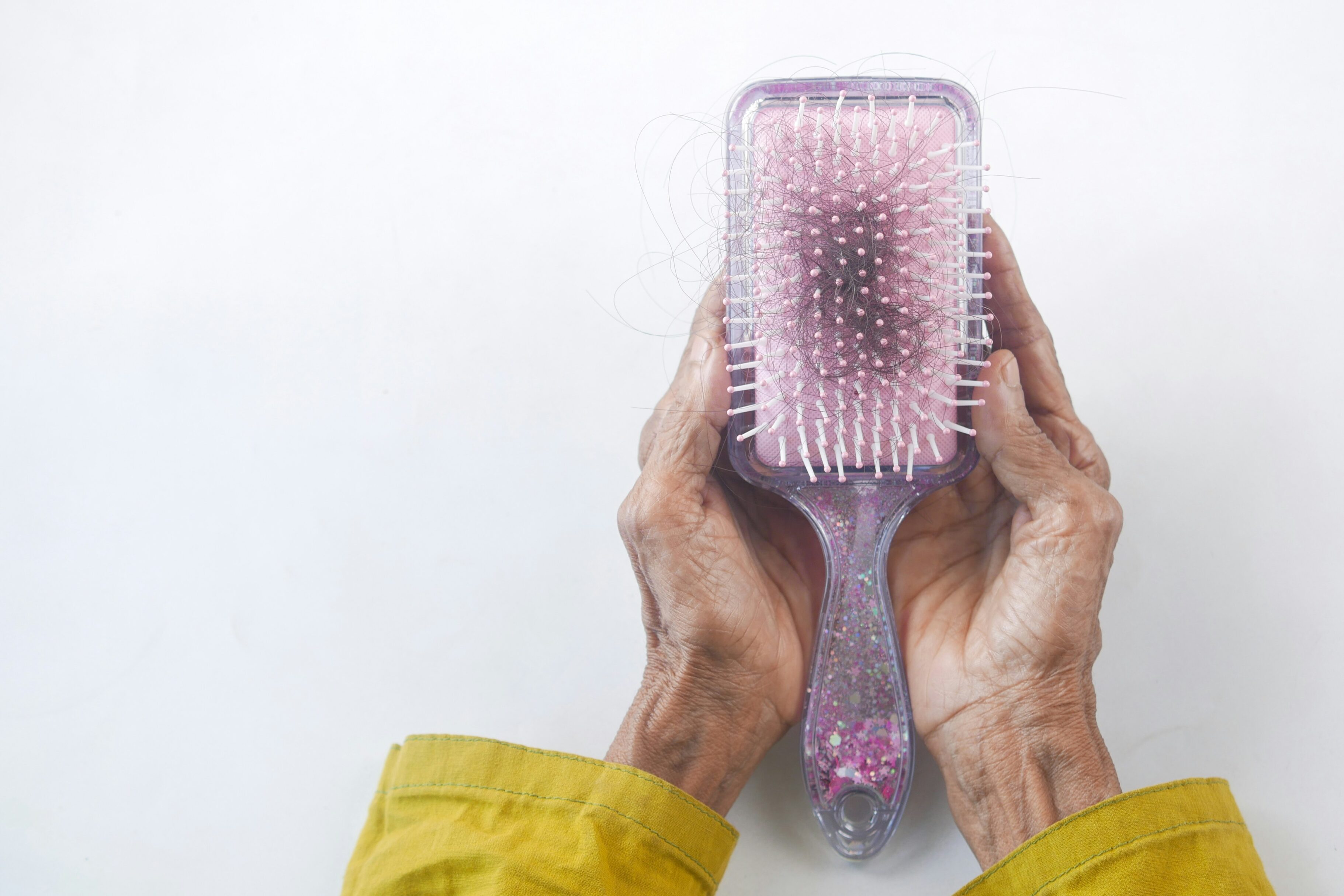 Alopecia