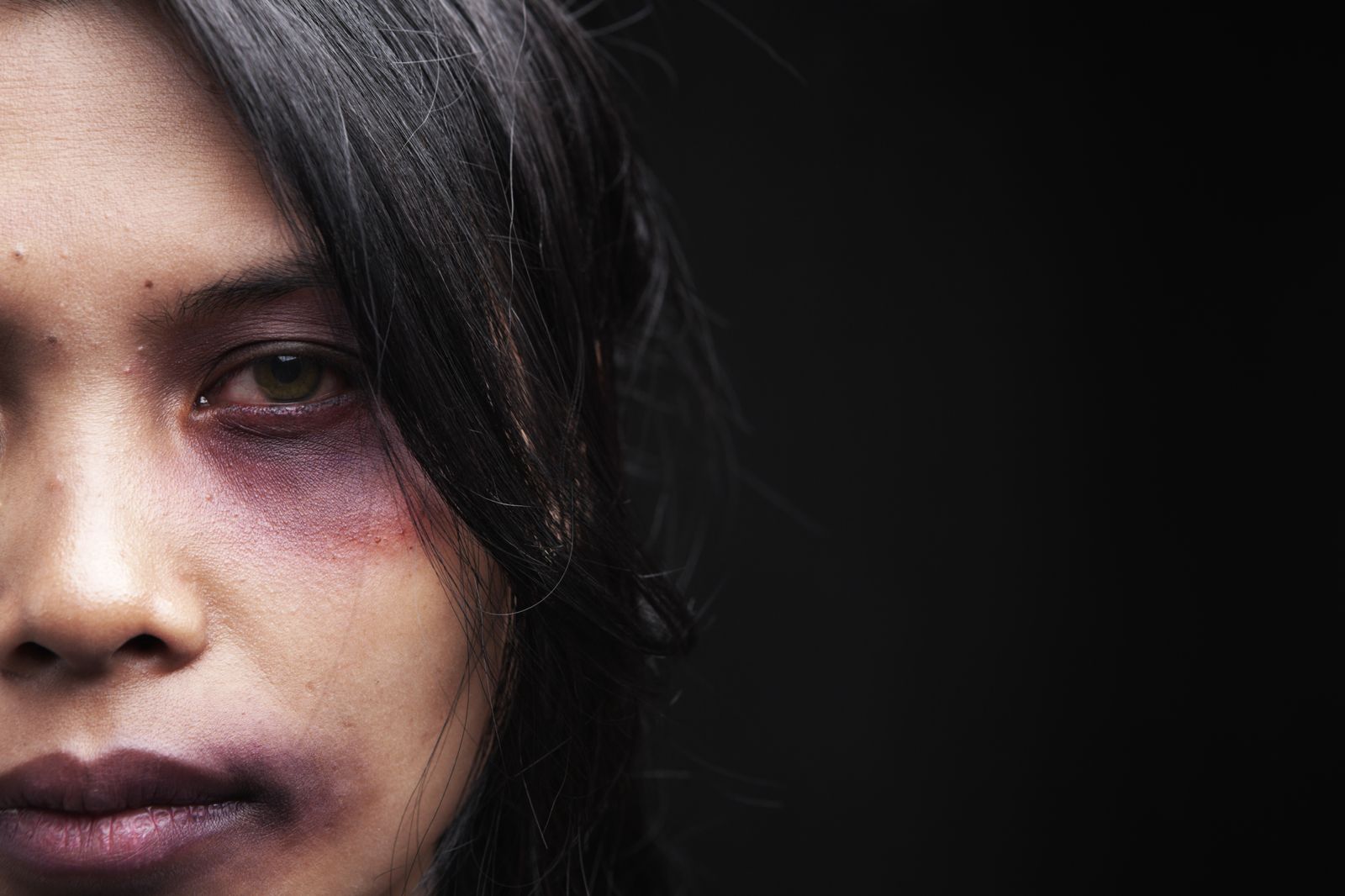 Cali enfrenta preocupante panorama de violencia contra las mujeres: 851 casos en lo que va del año