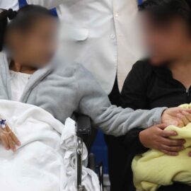 Bebé nace tras embarazo ectópico hepático en Perú: caso único en el mundo