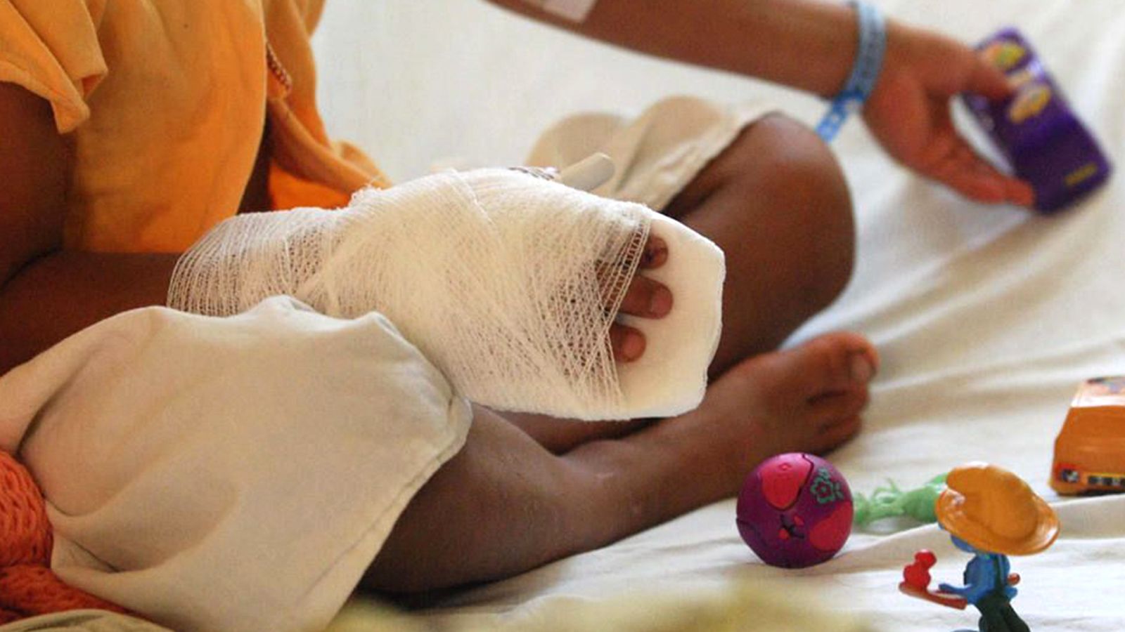 Aumentan los quemados con pólvora en el Valle del Cauca: autoridades en alerta