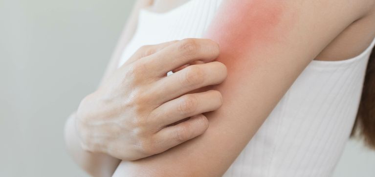 Ojo: Este es el mejor tratamiento para manejar la dermatitis en niños y adultos