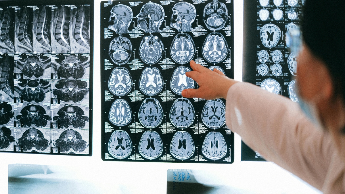 ¿Las carillas son buenas para los dientes o les hacen daño? Experta aclara duda