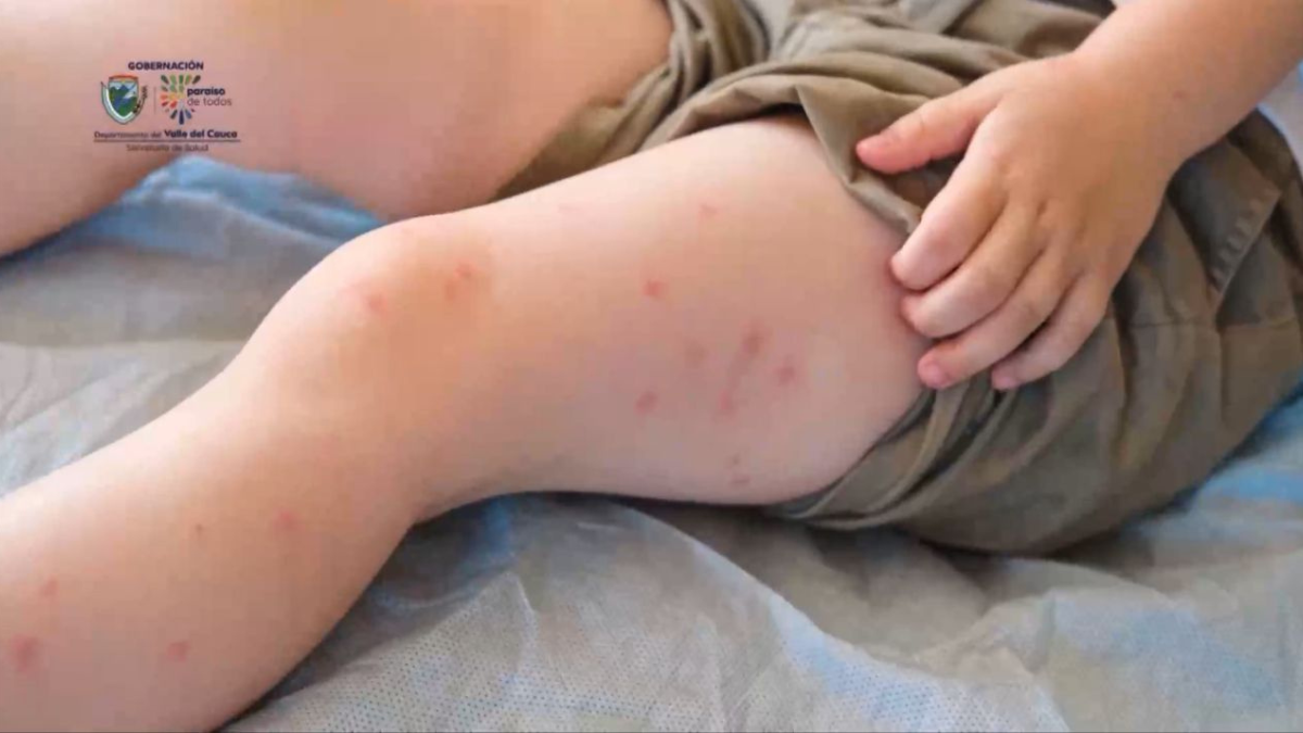 Drama para niños con enfermedades huérfanas: denuncian suspensión de servicios de Emssanar