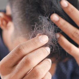 Mitos sobre la alopecia: experta brinda recomendaciones y despeja dudas