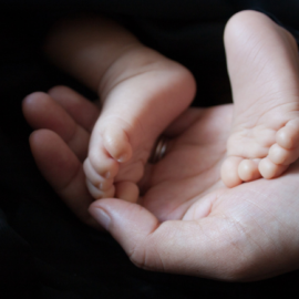 ¿Su bebé se puso amarillo después de nacer? Ojo a las señales de una ictericia neonatal