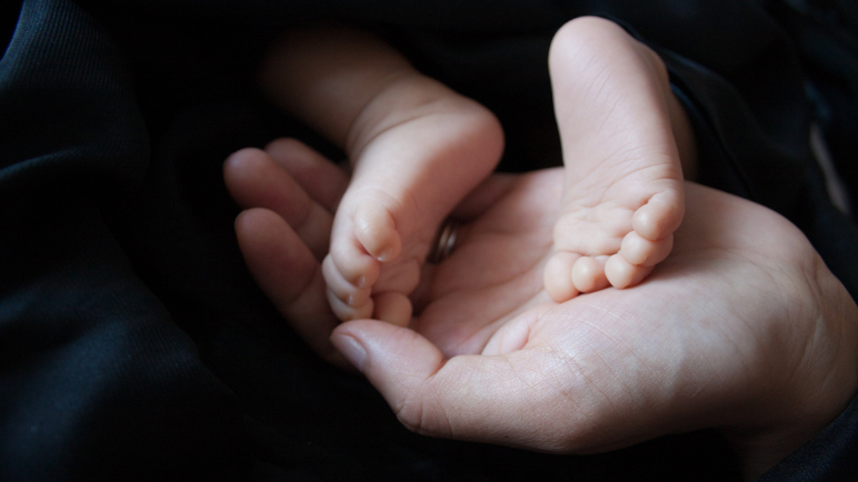 ¿Su bebé se puso amarillo después de nacer? Ojo a las señales de una ictericia neonatal